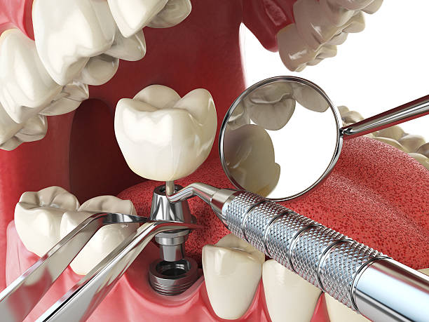 Best Emergency Treatment for Toothache in Elkridge, MD